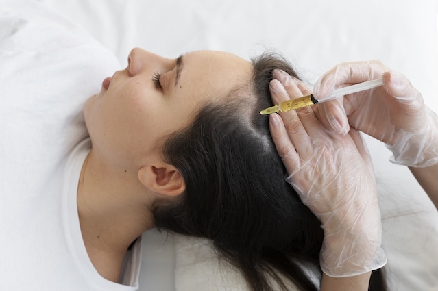 Left profile of a woman from the shoulders up, getting a syringe with yellow PRP fluid injected into her hairline by a pairs of hands in transparent surgical gloves