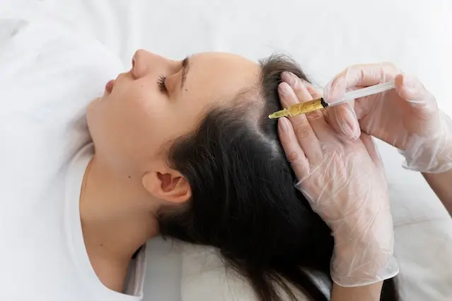 Left profile of a woman from the shoulders up, getting a syringe with yellow PRP fluid injected into her hairline by a pairs of hands in transparent surgical gloves